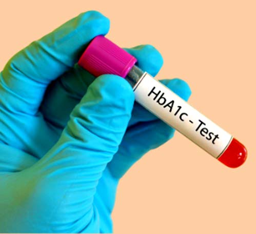 HBA1c
