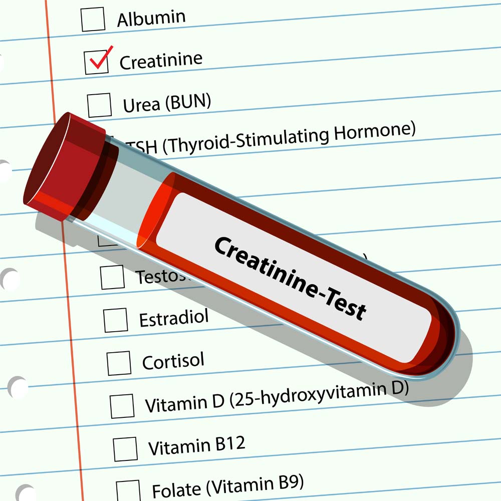 s_creatinine